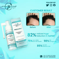 Procapil+ Hair Regrowth Treatment Spray